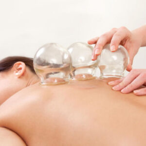 Schröpfen Massage in Shanghai